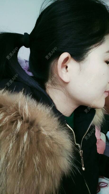 更美 - 洁儿888的经验 | 招风耳矫正 | 常德