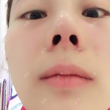 李生蚝
