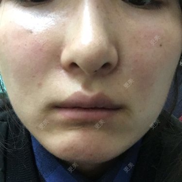杉哥哥