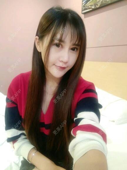 更美 - 更美用户AMKLgt8fpB的玻尿酸经验 | 美购日记 | 祛法令纹 | 玻尿酸 | 温州