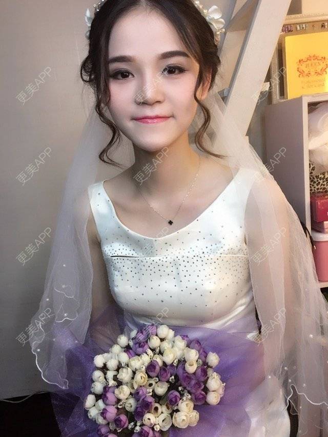 更美 - 莫宁🌸的经验 | 假体隆鼻 | 隆鼻功课 | 广州