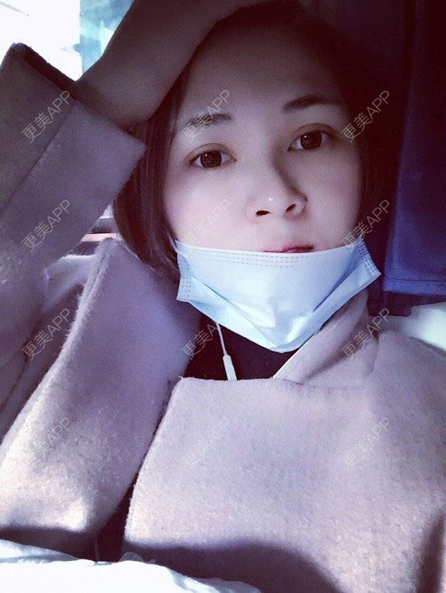 更美 - 韩小舞的全切双眼皮经验 | 全切双眼皮 | 宁波