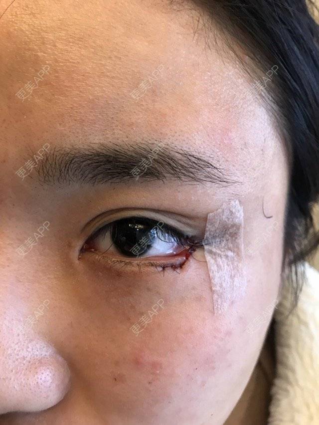 嘢猫的眼睑下至日记