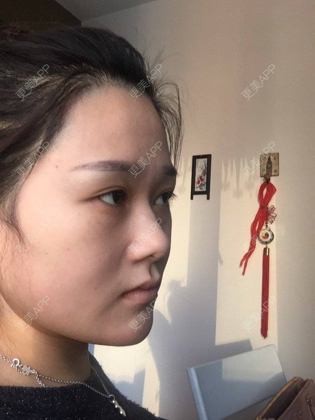 更美 - C0C007🍒的经验 | 外开眼角 | 沈阳