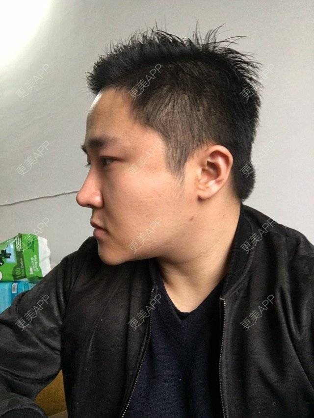更美 - 景潇哥哥的经验 | 减肥瘦身 | 宁波