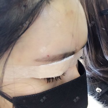小菊花