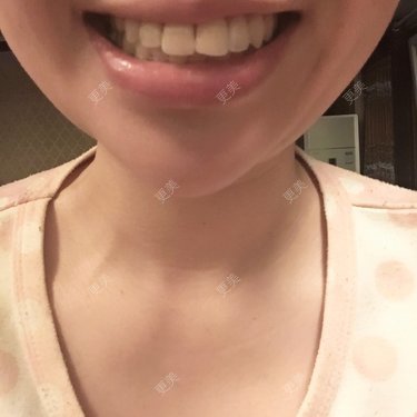 不想睡觉的豆豆