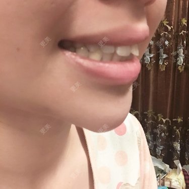 不想睡觉的豆豆