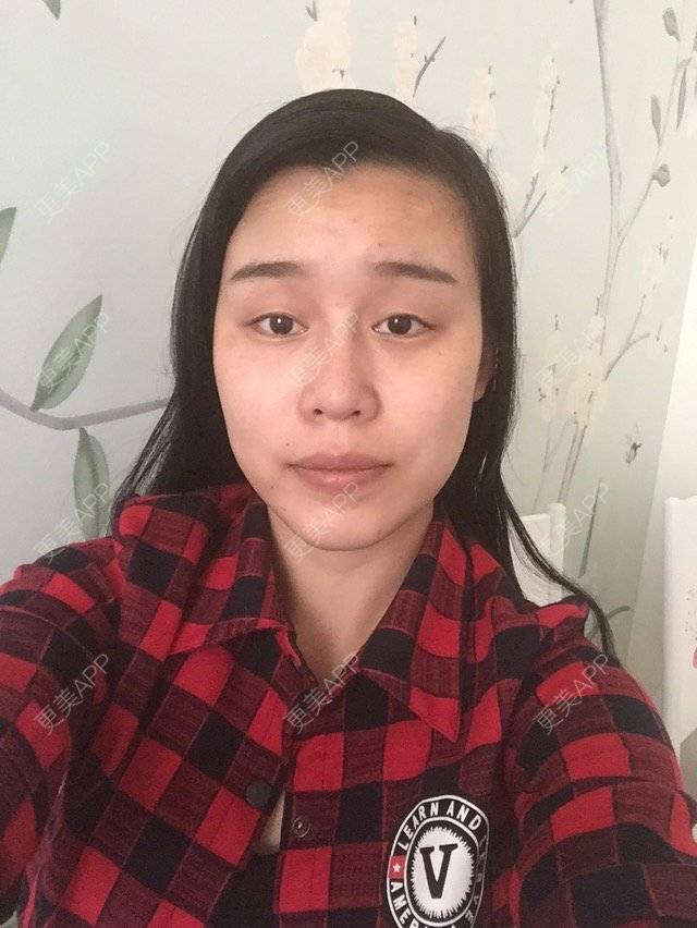 更美 - 更美用户THNkuzuA2m的经验 | 在线面诊 | 徐学东
