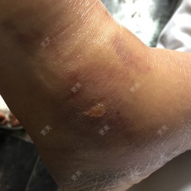 更美用户4681813193