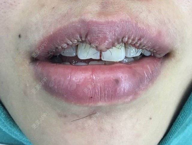 更美用户tdum4zc2ly的唇形日记