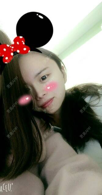 更美 - 甘蔗妹子的激光脱毛经验 | 美购日记 | 术后求抱抱 | 激光脱毛腋下 | 激光脱毛 | 武汉