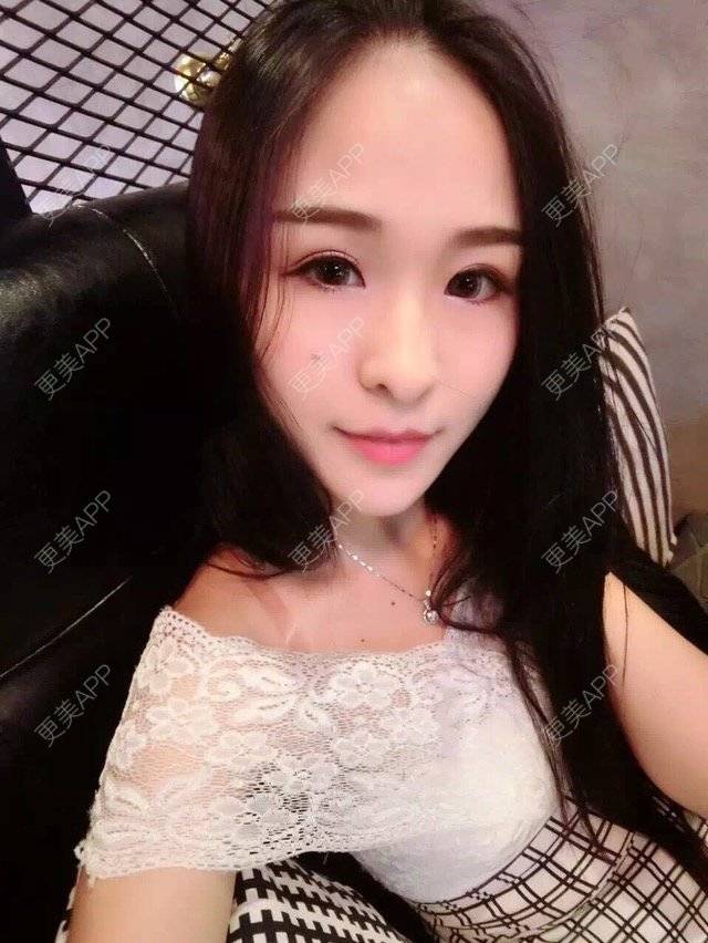 更美 - μ昕怡的吸脂经验 | 美购日记 | 抽脂塑形 | 腿部塑形 | 吸脂 | 重庆 | 视频日记