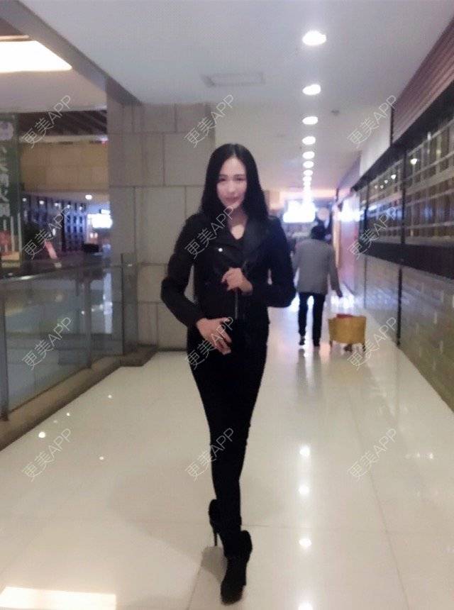 更美 - μ昕怡的吸脂经验 | 美购日记 | 抽脂塑形 | 腿部塑形 | 吸脂 | 重庆 | 视频日记