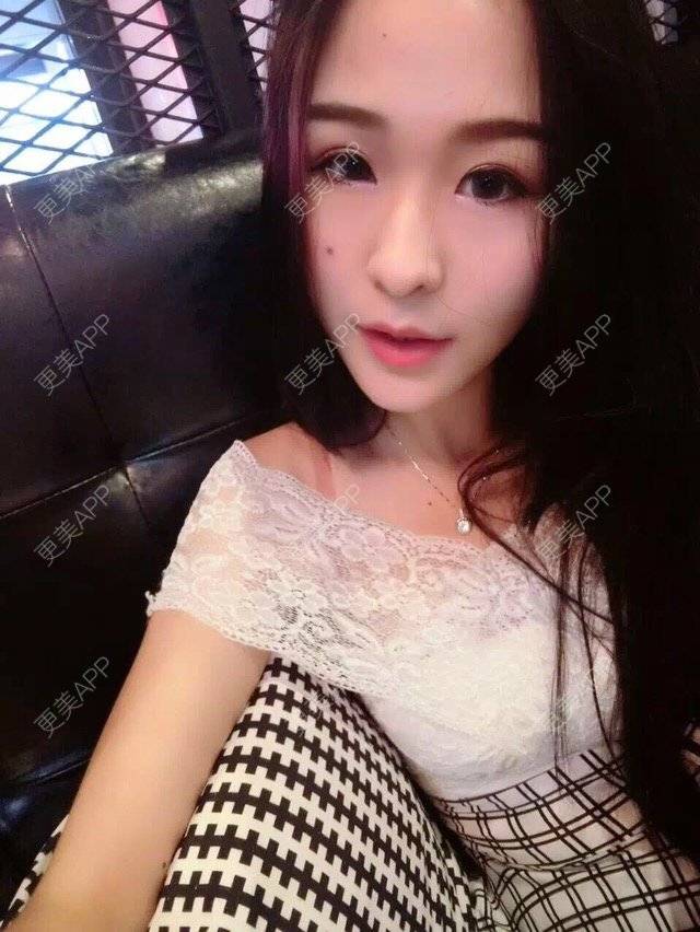 更美 - μ昕怡的吸脂经验 | 美购日记 | 抽脂塑形 | 腿部塑形 | 吸脂 | 重庆 | 视频日记