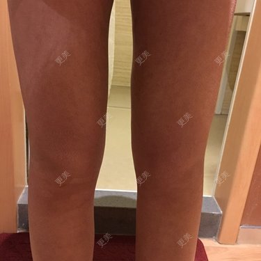 更美用户4681813193