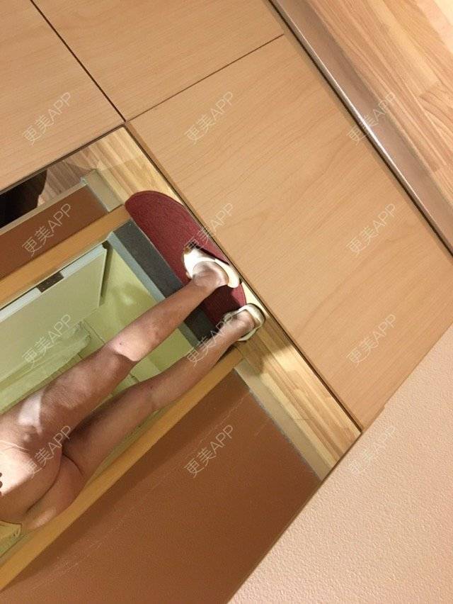 更美 - 更美用户4681813193的丰胸（隆胸）经验 | 美购日记 | 丰胸（隆胸） | 吸脂臀沟 | 郑州