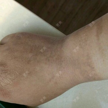 更美用户WUstmpfo9y