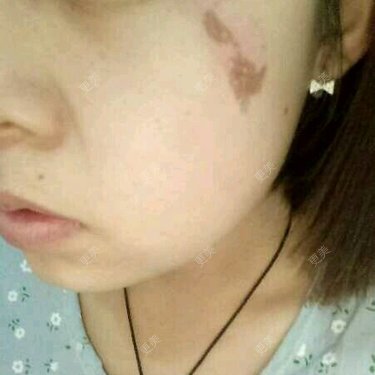 廖恒利 医生