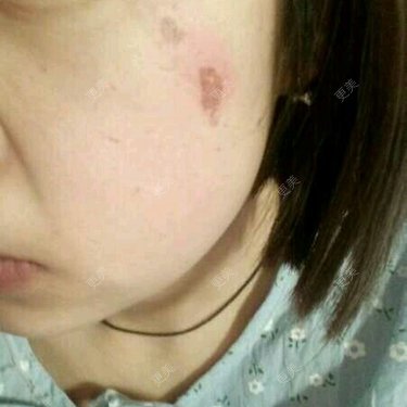 廖恒利 医生