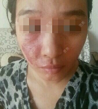 更美用户kl7JuxRrp7