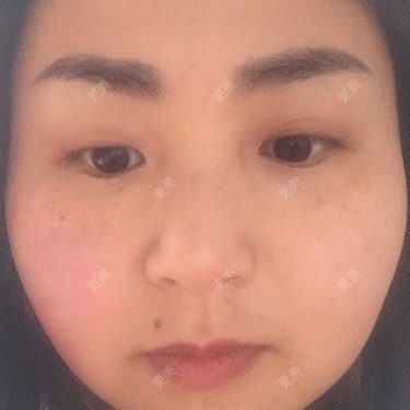 榆榆