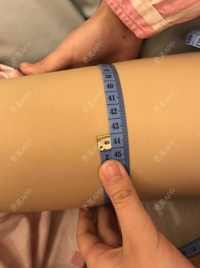更美 - 囍宝2333的吸脂经验 | 美购日记 | 吸脂 | 吸脂臀沟 | 吸脂大腿 | 重庆
