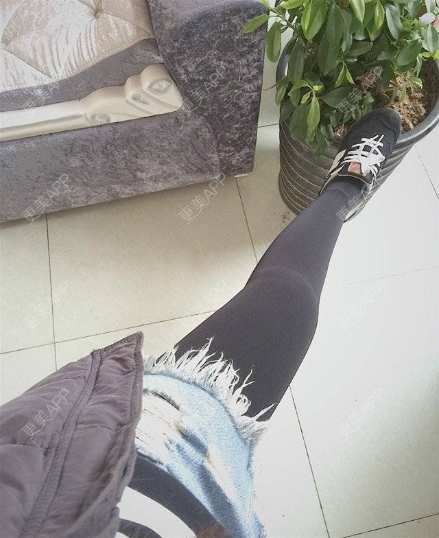 更美 - 慢漫曼小姐的吸脂瘦大腿经验 | 宁波 | 吸脂瘦大腿