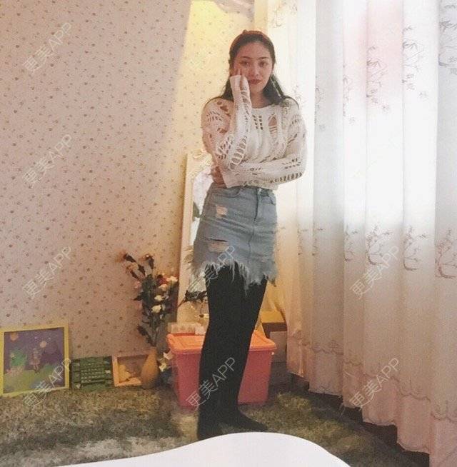 更美 - 慢漫曼小姐的吸脂瘦大腿经验 | 宁波 | 吸脂瘦大腿