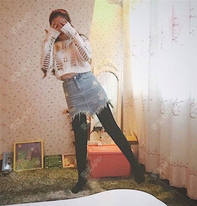 更美 - 慢漫曼小姐的吸脂瘦大腿经验 | 宁波 | 吸脂瘦大腿