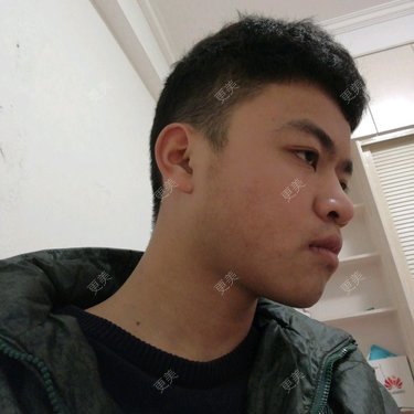 感觉左右脸额不对称呀感觉一边要突出些还有就是侧面不能忍的丑怎么耍