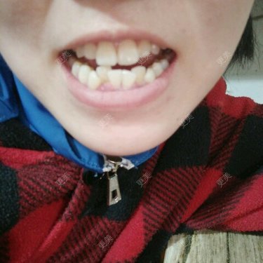 一笑不倾城的微微