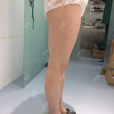 筷子腿腿