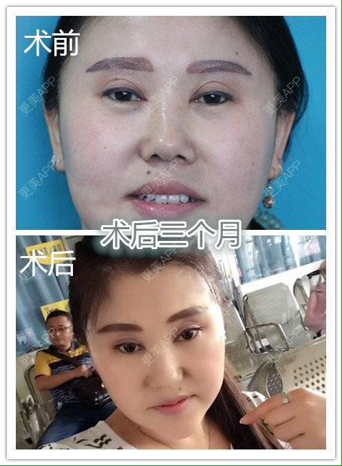 更美 - 魏志香 医生的经验 | 眼部整形 | 眼部整形1 | 北京