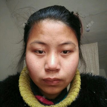 更美用户pRV0MedKAO