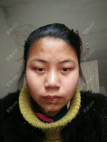 更美 - 更美用户pRV0MedKAO的经验 | 产后修复 | 瘦身美体 | 皮肤美容 | 滁州