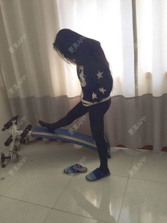 更美 - 慢漫曼小姐的吸脂瘦大腿经验 | 宁波 | 吸脂瘦大腿