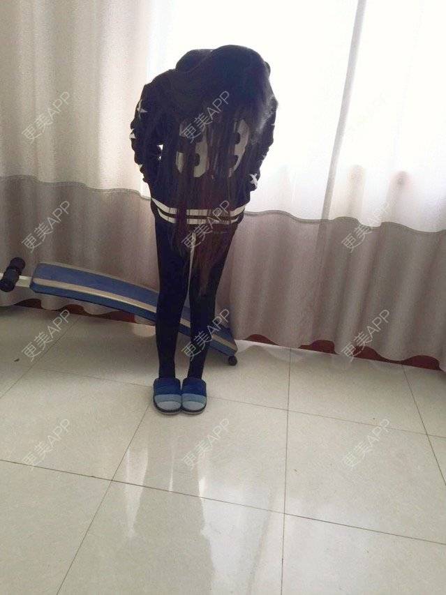 更美 - 慢漫曼小姐的吸脂瘦大腿经验 | 宁波 | 吸脂瘦大腿