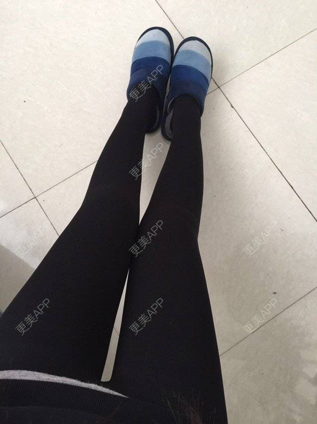 慢漫曼小姐的吸脂瘦大腿日记