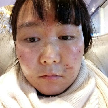 整形模拟器