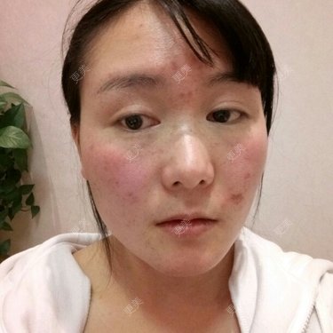 整形模拟器
