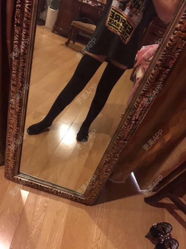 更美 - 慢漫曼小姐的吸脂瘦大腿经验 | 宁波 | 吸脂瘦大腿