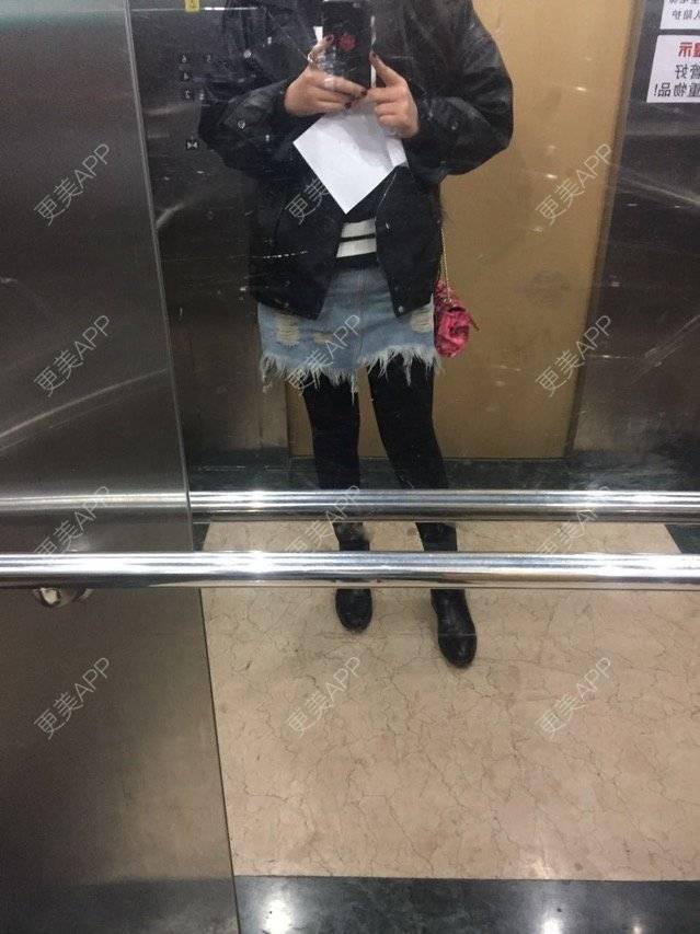 更美 - 慢漫曼小姐的吸脂瘦大腿经验 | 宁波 | 吸脂瘦大腿