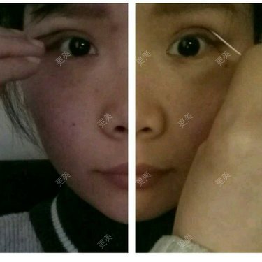 小诚子Y