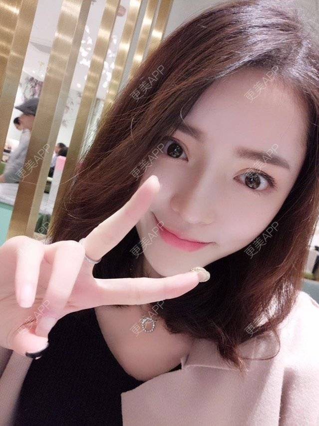 更美 - 玥玥子子的经验 | 隆鼻假体 | 西安