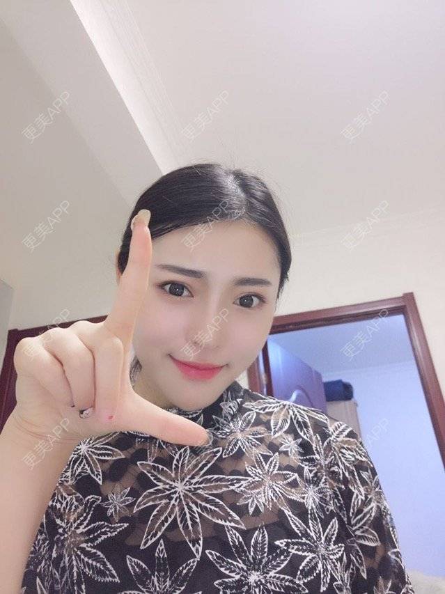更美 - 玥玥子子的经验 | 隆鼻假体 | 西安
