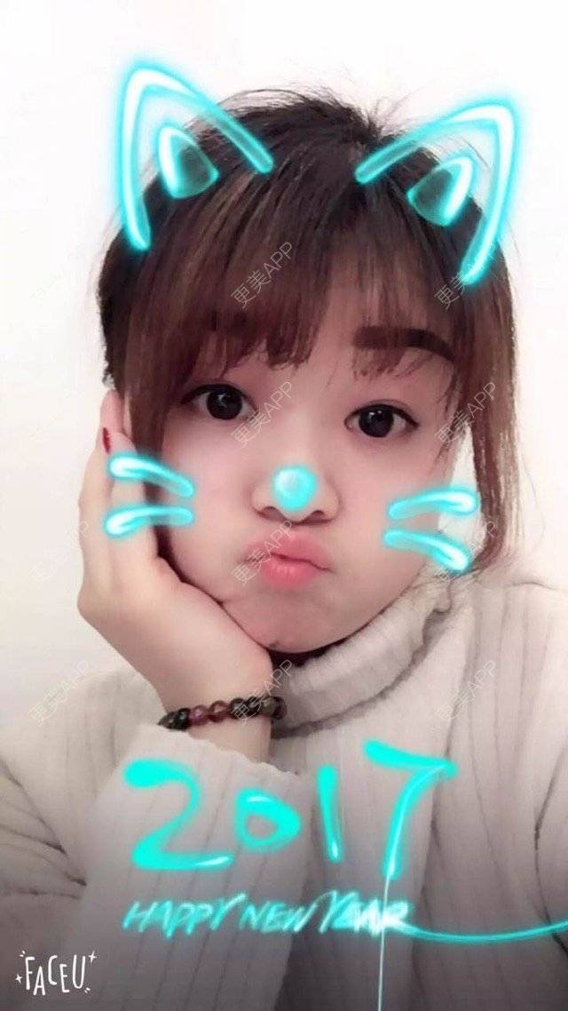 更美 - Mimo 兰的眼皮下垂矫正经验 | 上海 | 眼皮下垂矫正