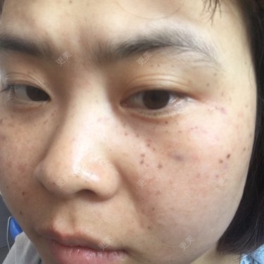 圆婷