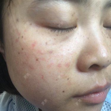 圆婷