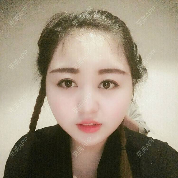更美 - ＊流年碎影的经验 | 面部轮廓 | 磨骨瘦脸 | 商丘